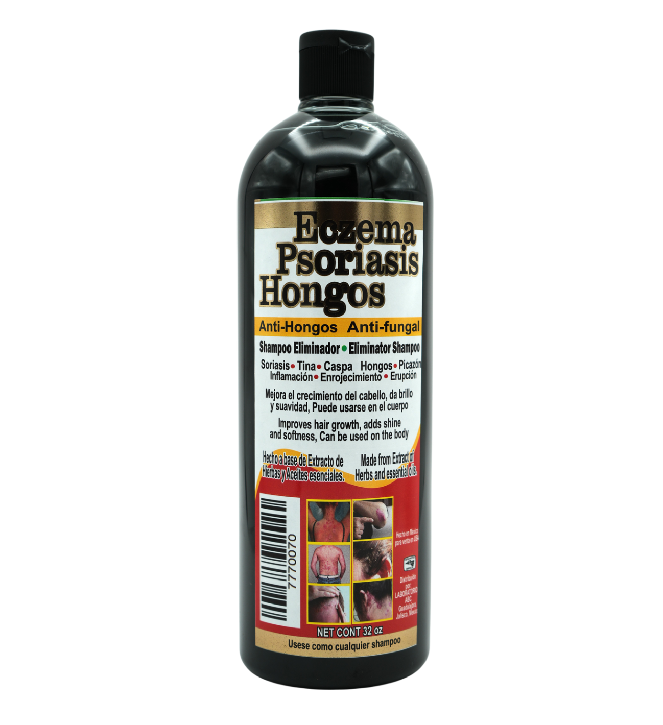 Shampoo para Eczema Psoriasis Hongos (3PC)